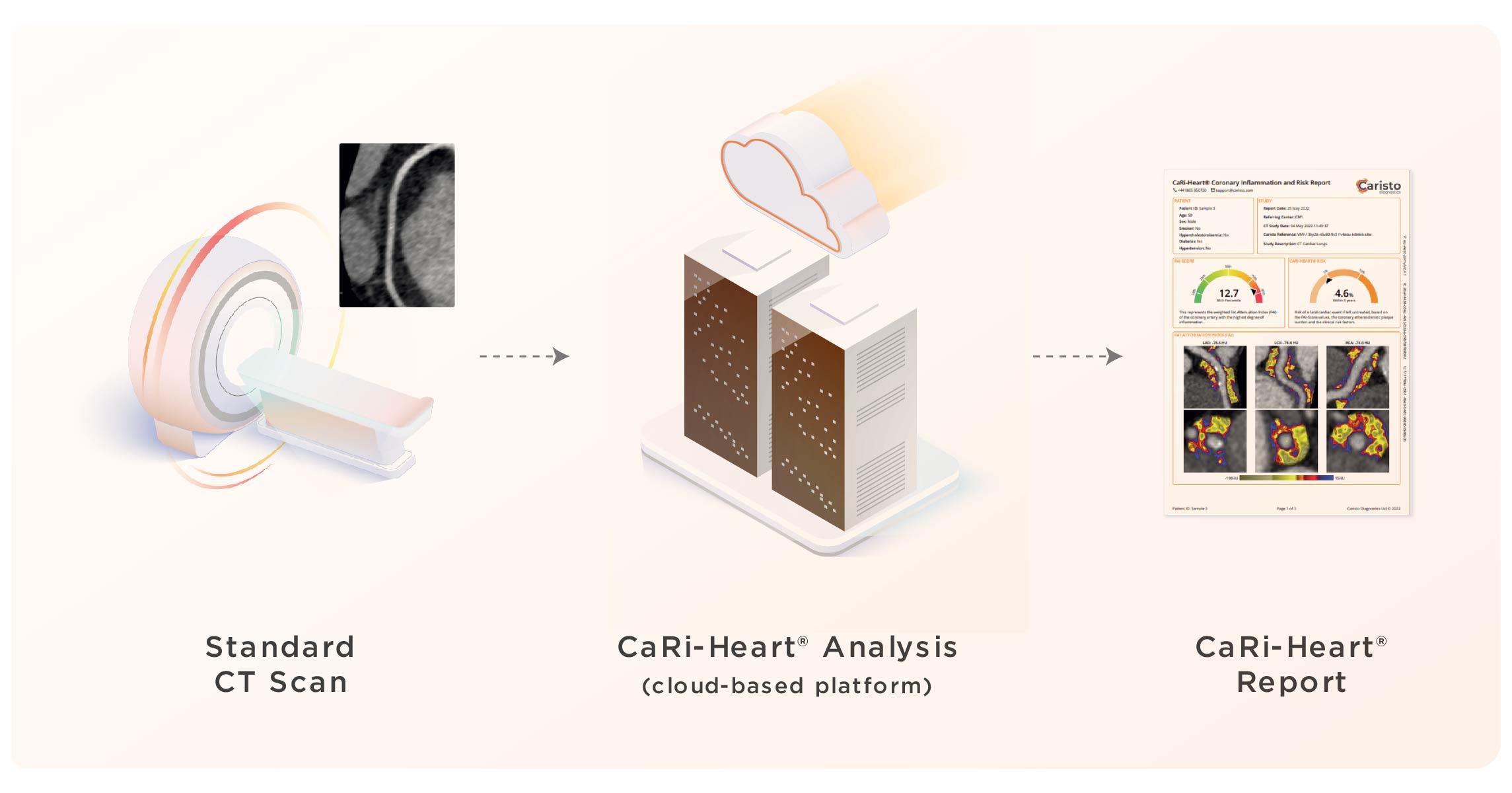 CaRi-Heart Workflow