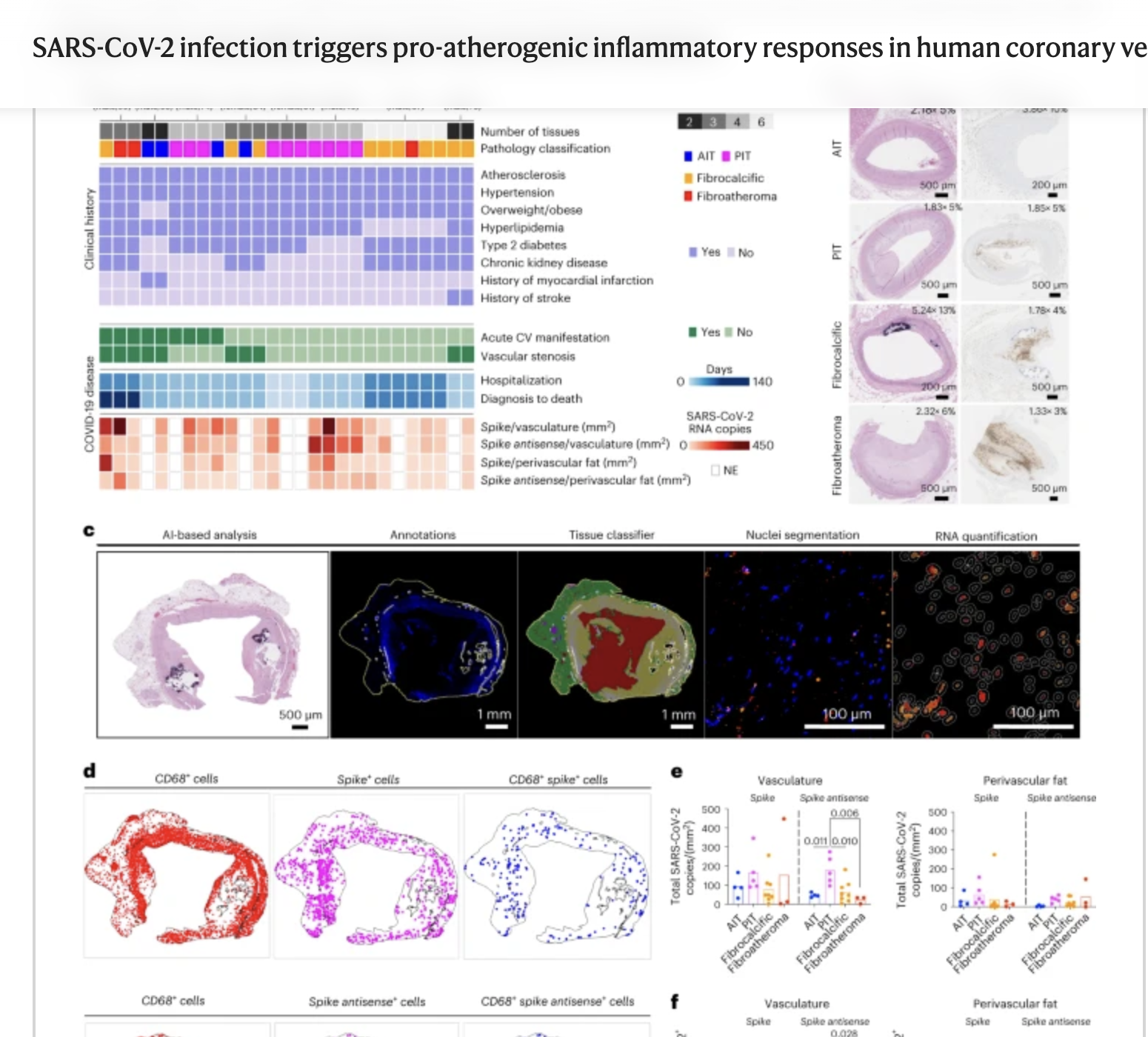 SARS-CoV-2 vRNA in human coronary arteries from deceased individuals with COVID-19 is identified using AI-based spatial analysis.